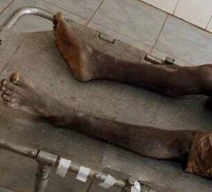 Nord-Kivu : un jeune de 18 ans lynché après une tentative de vol à Beni